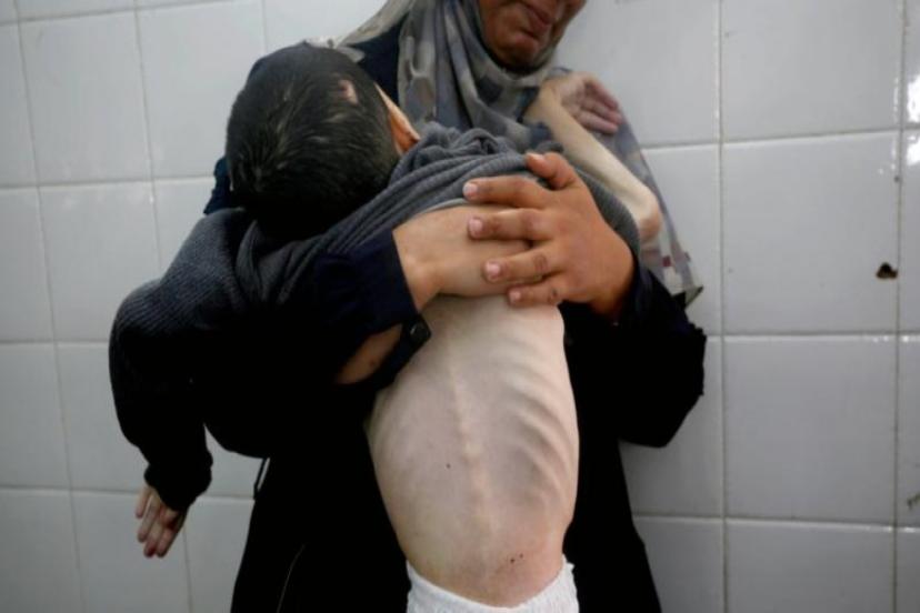 GAZZE'DE 5 AYLIK BEBEK AÇLIKTAN HAYATINI KAYBETTİ