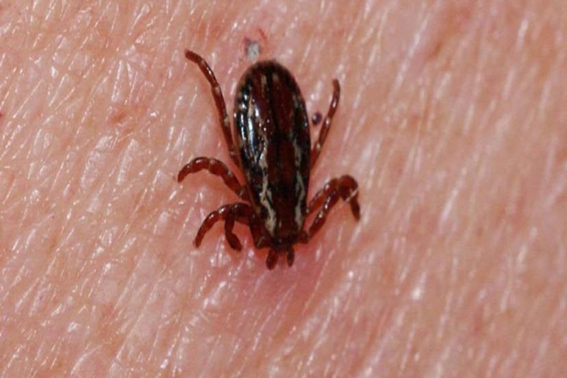 KAYSERİ'DE KKKA HASTALIĞI ŞÜPHESİYLE TEDAVİ GÖREN KİŞİ ÖLDÜ