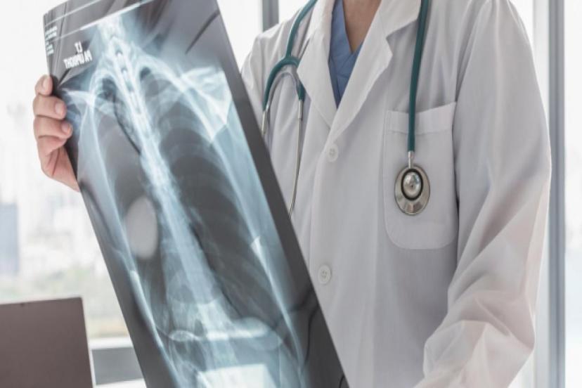 VEREM, TÜRKİYE'DE ARTIK KORKUTUCU BİR TEHDİT DEĞİL